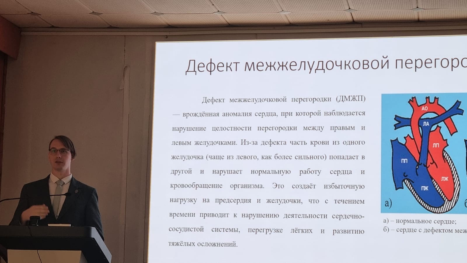 Успех кафедры «Биомедицинская техника»: успешная защита кандидатской диссертации по диагностике детских пороков сердца